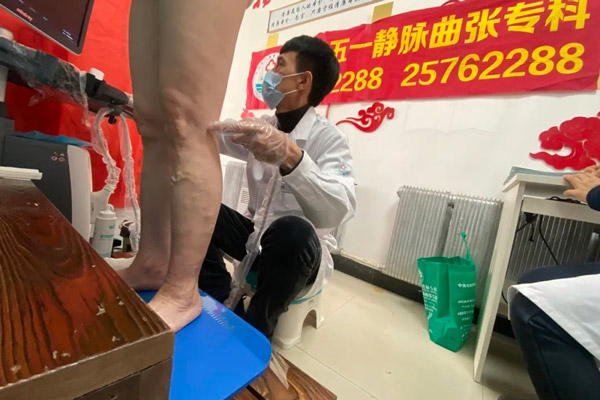 下肢静脉曲张（蚯蚓腿），沈阳静脉曲张专科医院五一静脉曲张专科带您全面了解下肢静脉曲张的诊断与治疗